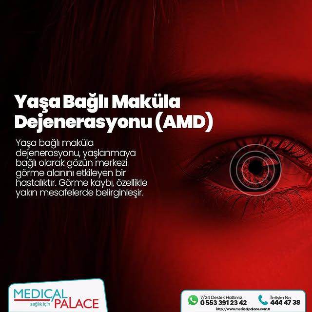 Yaşa Bağlı Makula Dejenerasyonu Nedir?