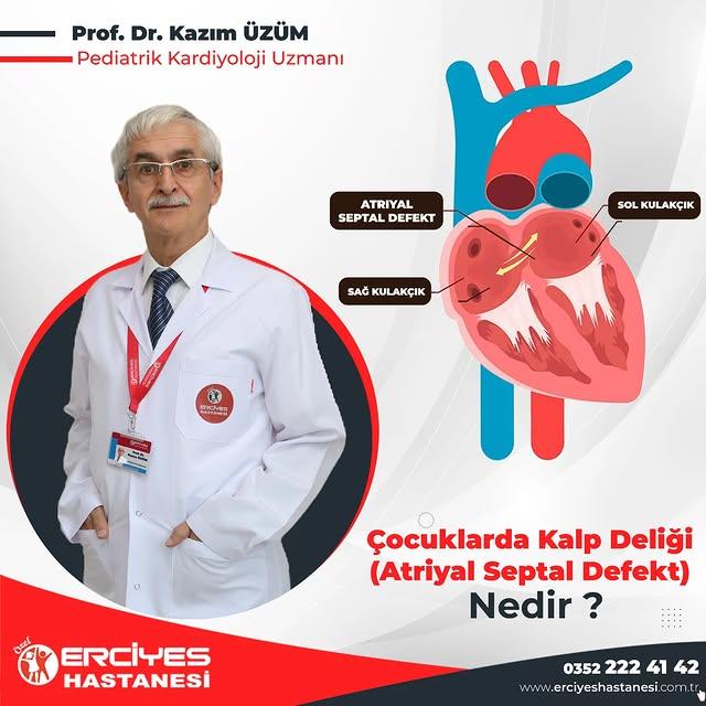 Atrial Septal Defekt (ASD) Nedir?