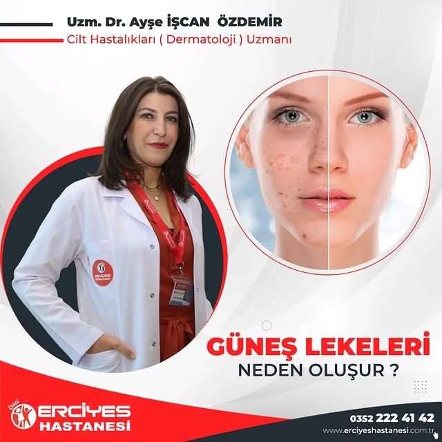 Güneş Lekeleri ve Oluşma Nedenleri